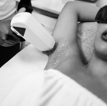 laser hair removal service laser hair removal service